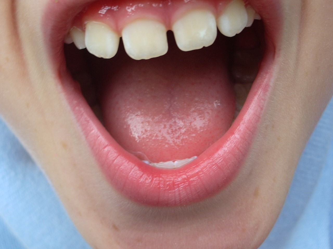 Estética dental | SMILE cliníca dental